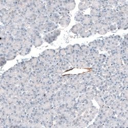 Integrin beta 3/CD61 Antibody (CL7319), Novus Biologicals 25 &mu;L; Integrin